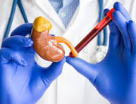 Kidney Package Profile